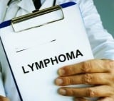 CAR-T cell therapy, bone marrow transplant boosting Lymphoma outcomes: Experts