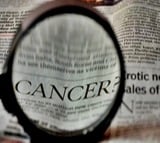 India’s 1st multi-omics data portal to boost cancer research, treatment