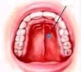 Smokeless tobacco, betel nut drive oral cancer cases in India, highest in South Asia: Lancet