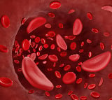 ICMR, Zydus tie up for clinical trial to combat sickle cell disease