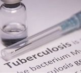 India accounts for 26 pc of global TB burden, the highest: WHO