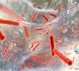 New species of superbug behind spike in severe human infections