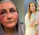 Hit with gun and dragged by hair, Pakistani actress reveals brutal torture