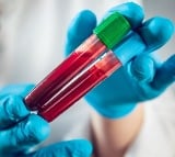 Blood-biomarker tests may aid in early diagnosis of Alzheimer’s: Report