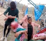 Girl's hair gets entangled in swing's rod in Uttar Pradesh; scalp ripped off