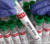 US confirms first case of clade I mpox in California