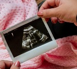 Surrogacy: NHRC questions Telangana Police over harassment of women