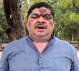 Ponnam Prabhakar says will invite KCR and Bandi Sanjay