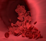 foods that help increase platelet count naturally