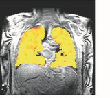 Scientists develop scan that unravels secrets of lung function