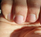 The telltale signs of poor health that your hands reveal