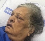 Denied Wheelchair By Air India 82 Year Old Woman Falls Lands In Hospital