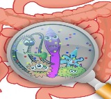 Common gut bacteria can make diabetes, cancer drugs less effective: Study