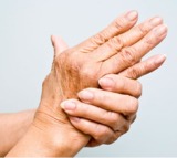 Study finds common blood fat linked to rheumatoid arthritis in women