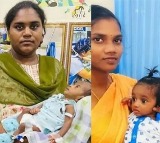 Mahesh Babu’s Foundation Crosses 4,500 Pediatric Surgeries Mark