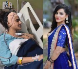 Telugu Actress Ashu Reddys Brave Fight After Brain Surgery
