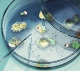 Global Spread of Aspergillus Sparks Health Crisis Warnings