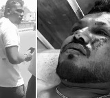 Vishwash Kumar Ramesh Survives Ahmedabad Air India Plane Crash
