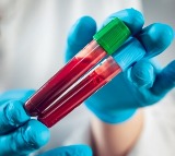 Deadly blood cancer can now be detected early with blood test: Study
