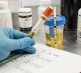 Uric Acid Linked to Heart Attack Risk