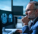 Stateviewer AI Tool Detects 9 Types of Dementia with Single Scan