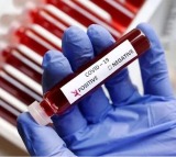 ICMR AIIMS reveal reasons for post Covid deaths