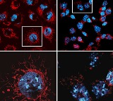 Study decodes why promising cancer treatments trigger serious side effects