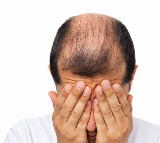 Home Remedies for Alopecia and Hair Loss