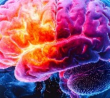 Women with Down syndrome at high risk of Alzheimer's disease: Study