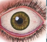 Heart Attack Symptoms Can Be Detected Early with Eye Exam