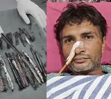 Doctors Shocked to Find 29 Spoons 19 Toothbrushes in Mans Stomach in Ghaziabad