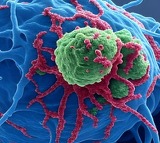 Covid mRNA vaccine may be used to fight lung skin cancer