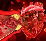 Heart Health Drinks to Prevent Artery Blockage