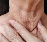 Turkey Neck Exercises to Reduce Neck Wrinkles