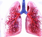 Chest X-rays inadequate to detect asymptomatic TB among household contacts: The Lancet