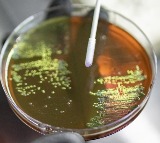 Early action on AMR key to ensure infections remain treatable, surgeries stay safe: WHO