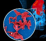 IIT Bombay study shows how TB bacteria shield themselves from antibiotics, stay alive longer