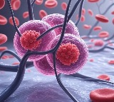 New antibody therapy shows promise for deadly blood cancer treatment