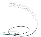 AIIMS-led trial on most advanced brain stent shows promise for stroke patients