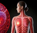 Disrupted sleep cycles linked to aggressive breast cancer says Study