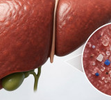 Plastic particles may trigger liver disease risk Researchers