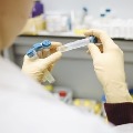 AstraZeneca To Run Fresh Global Vaccine Trial