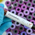 Coronavac Vaccine Works 99 Percent on Virus