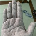 UP Doctor Hand Pic Goes Viral