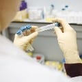 Russia Vaccine Sputnik is Not in Advance Stage Says WHO