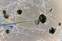 MSN Labs launches Posaconazole (PosaOne) to treat black fungus