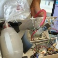 Telugu youth makes efficient ventilator with his team