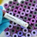 Three year Boy infected to Corona virus in Telangana