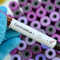 6 Corona virus hot spots identified in Telangana