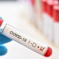 Tamil Nadu guy infected to Coronavirus while he came to Chittoor